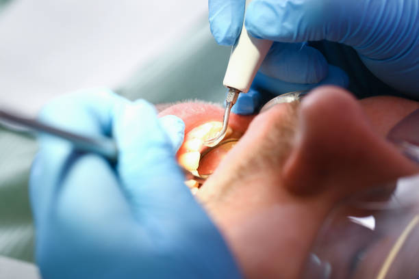 Best Emergency Tooth Extraction  in Spearman, TX